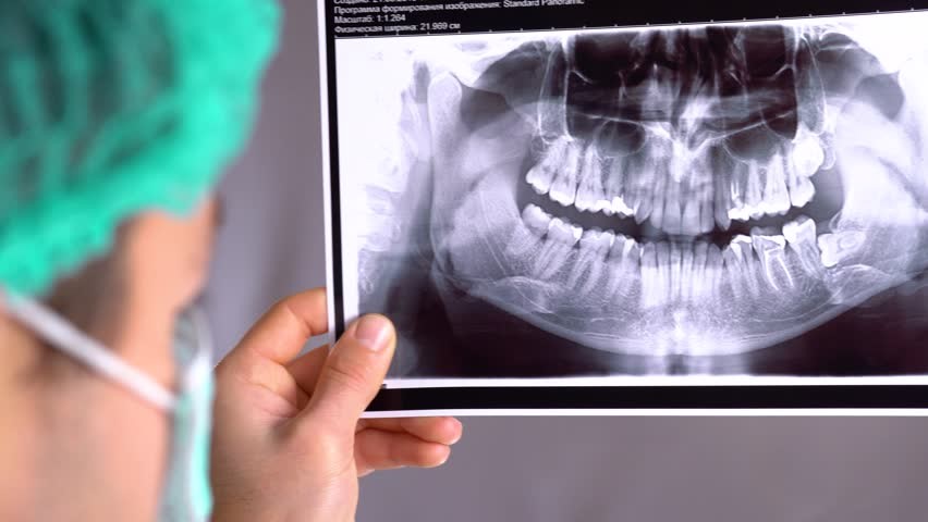 کاربرد عکس بایت وینگ در دندانپزشکی