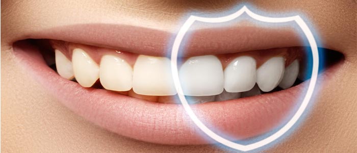 کاربرد ژل اسید اچ در دندانپزشکی