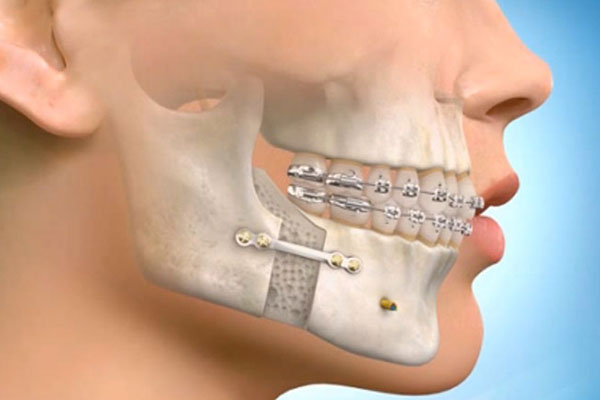 ابزار های لازم برای جراحی در دندانپزشکی