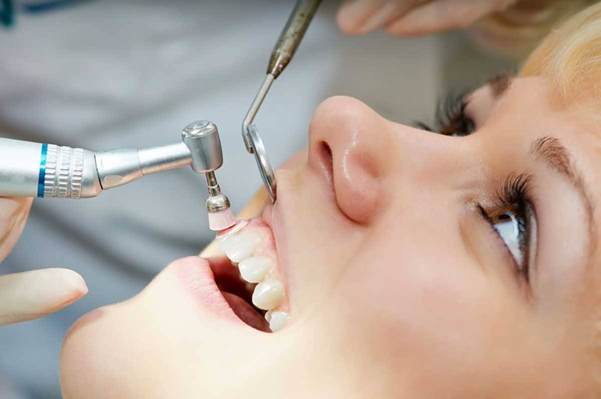 مرحله دوم: بروساژ دندان