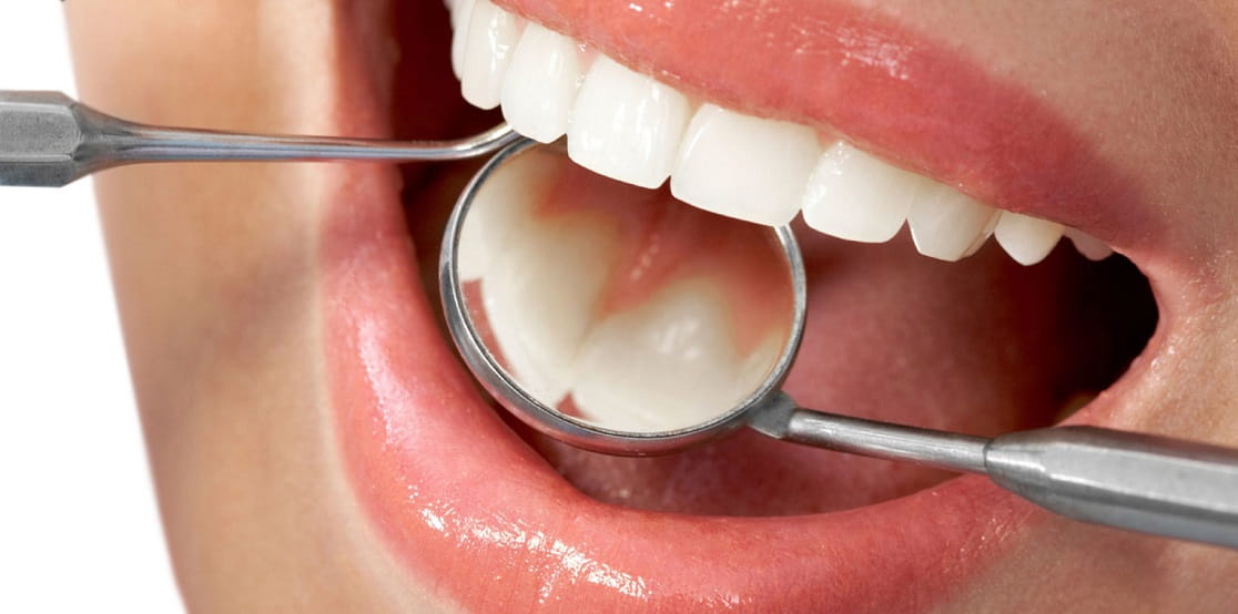Dental restoration types