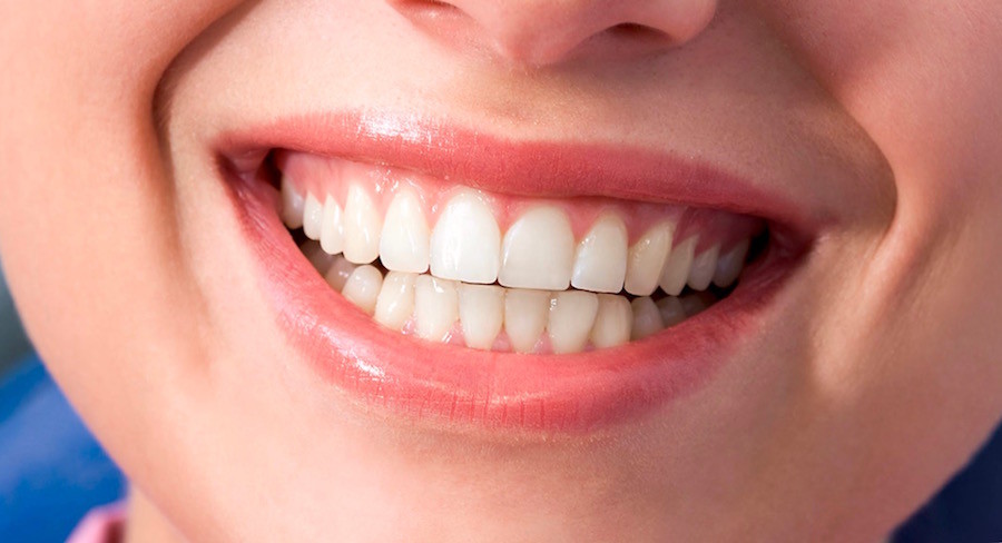 How to Get Better Looking Gums