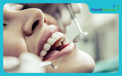 خمیر پرکردن دندان چیست؟