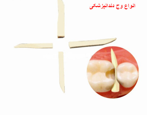 انواع وج دندانپزشکی
