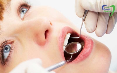آلرژی در دندانپزشکی
