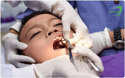 انبرک دندانپزشکی