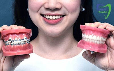 ابزار ارتودنسی دندانپزشکی