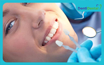 کامپوزیت رایج ترین مواد ترمیمی دندان