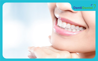 روش های سفید کردن دندانپزشکی