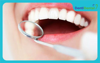مواد سفید کننده دندان چیست