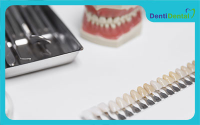 انواع کامپوزیت دندان چیست؟