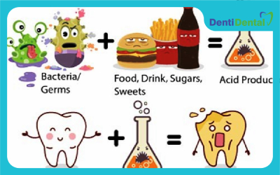 کمبود ویتامین و پوسیدگی دندان